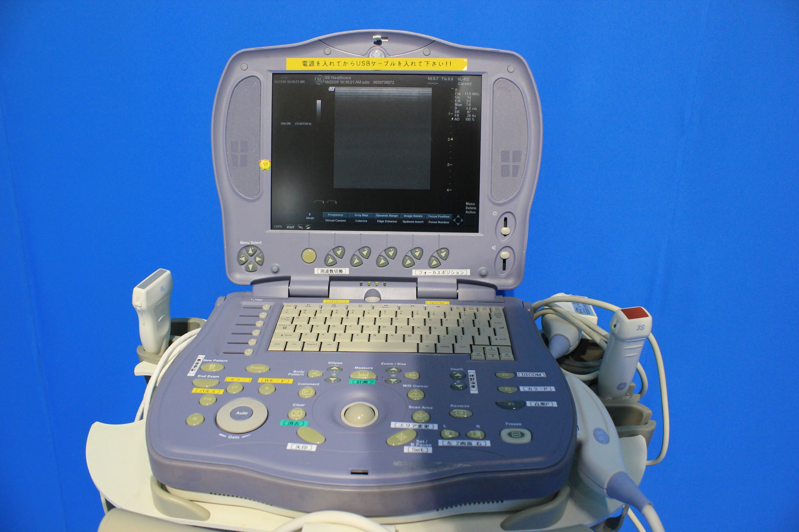 Used GE HEALTHCARE GE MRX BOARD for LOGIQ E9 MODEL: 5393908