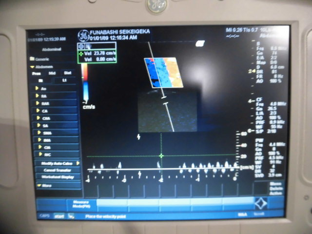 Product detail｜10403｜GE｜Ultrasound｜LOGIQ BOOK｜Fair
