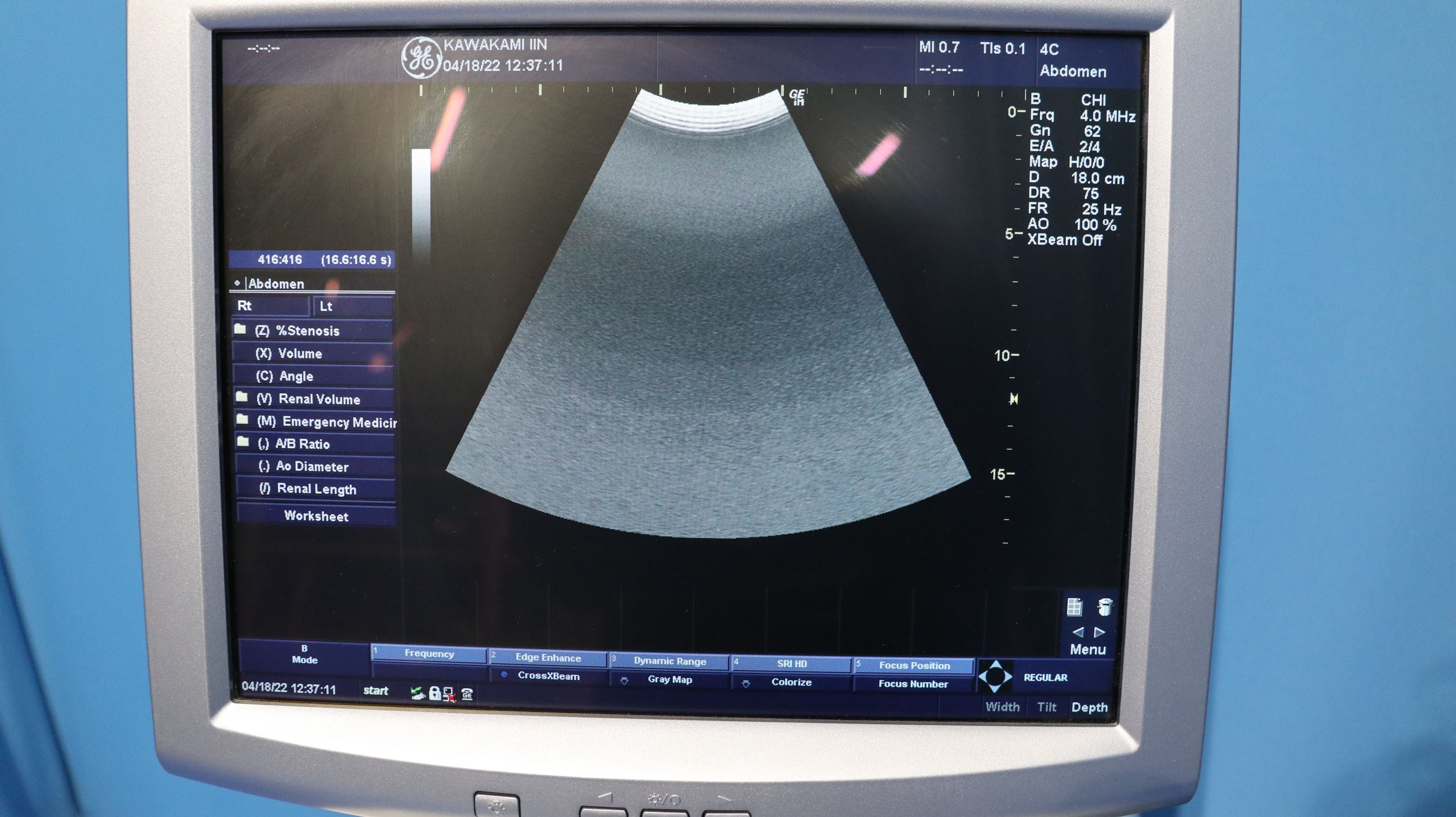 Product detail｜13883｜GE｜Not Found｜LOGIQ iM｜Fair Medical