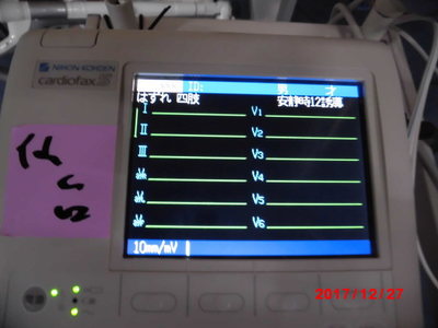 Electrocardiograph 2