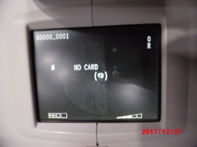 Non-mydriatic fundus camera 2