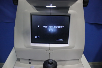 Non-mydriatic fundus camera 2