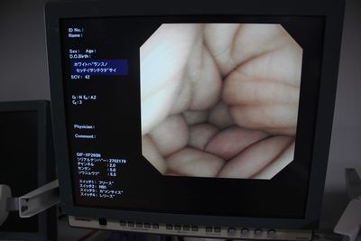Video scope for nasal 2