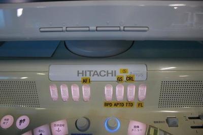 The ultrasonic diagnostic apparatus 2