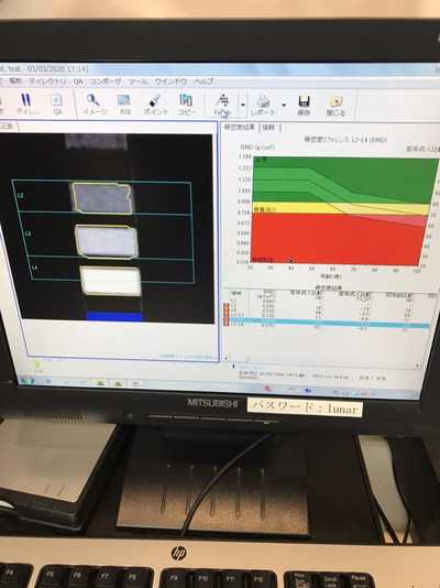 Dexa Scan 2