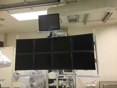 Angiography System 2