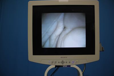 The endoscope system 2