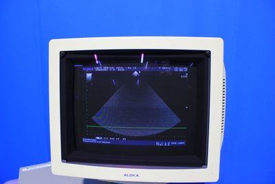 The ultrasonic diagnostic apparatus 2