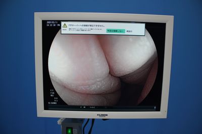 Endoscopy Light Source & Processor 2