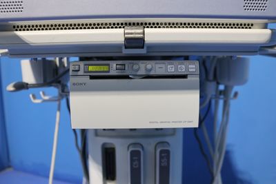 Portable Ultrasound Diagnostic Machine 2