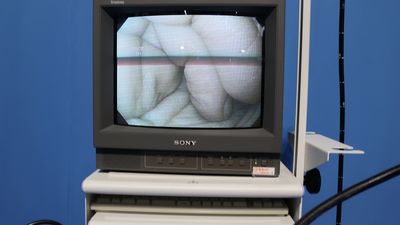 Upper gastrointestinal videoscope 2