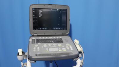 Portable Ultrasound Diagnostic 2