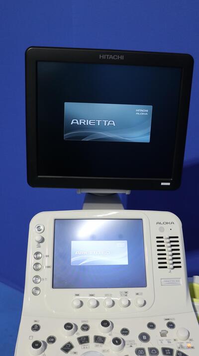 超音波診断装置の写真2枚目