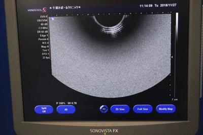 The ultrasonic diagnostic apparatus 3