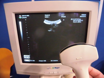 Ultrasound 3