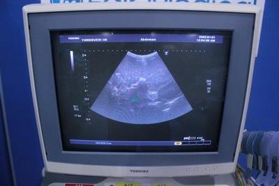 The Ultrasonic diagnostic apparatus Ultrasound 3