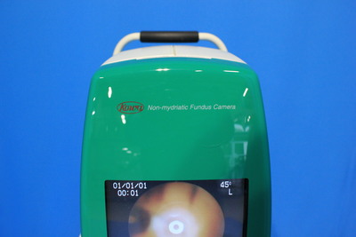 Non-mydriatic fundus camera 3