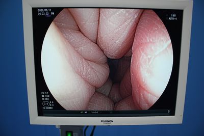 Endoscopy Light Source & Processor 3