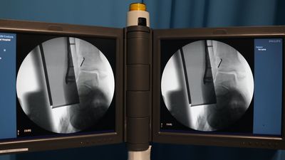 外科用X線TV装置(Cアーム)の写真3枚目
