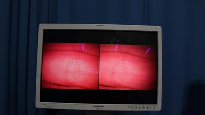 Surgical microscope 3