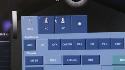The ultrasonic diagnostic apparatus 3