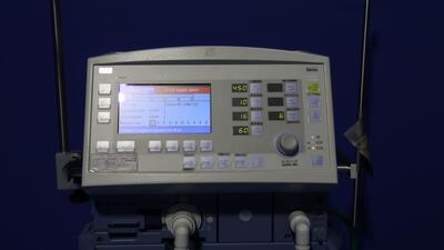 Ventilator 3
