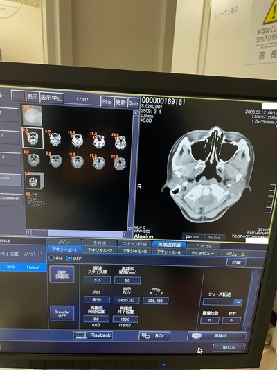Multislice Computerized Tomography System 3