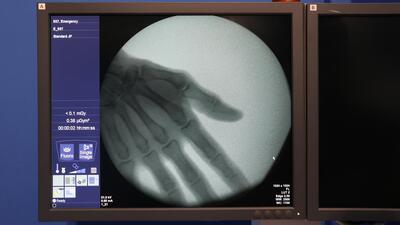 C-Arm 3