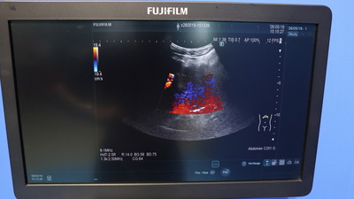 Ultrasound Diagnostic System 3