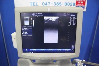 Ultrasound 4