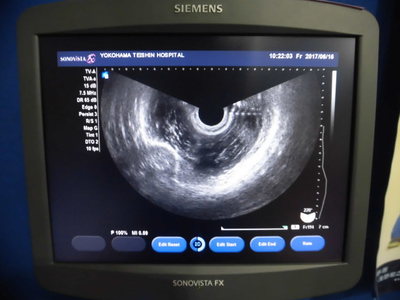 The ultrasonic diagnostic apparatus 4