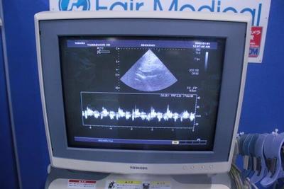 The Ultrasonic diagnostic apparatus Ultrasound 4