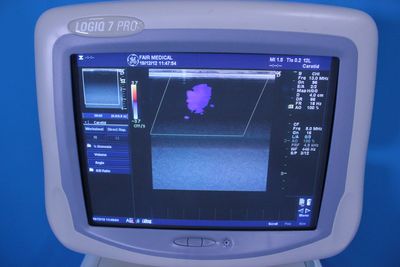 The ultrasonic diagnostic apparatus 4