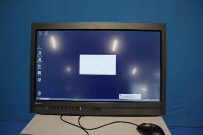 Computed Radiograph 4