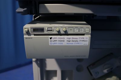 The Ultrasonic diagnostic apparatus Ultrasound 4
