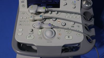 超音波診断装置の写真4枚目