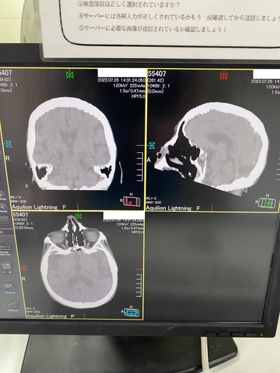 Multislice Computerized Tomography System 4