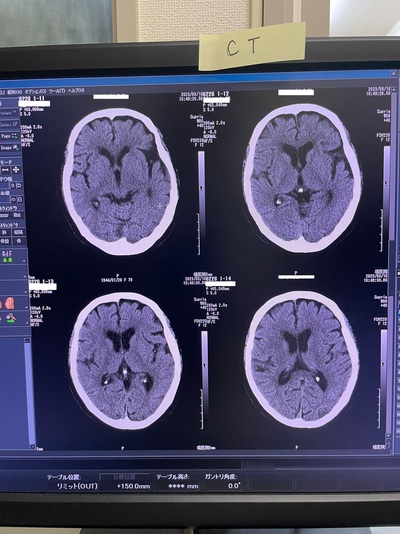 Multi-Slice CT Installation 4