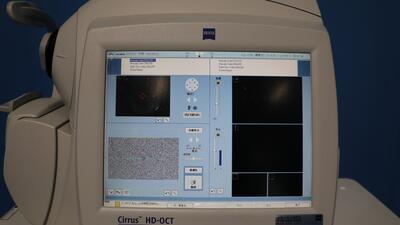 Optical Coherence Tomography 4