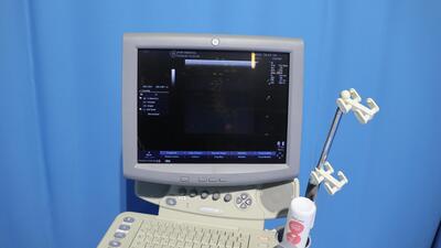 The ultrasonic diagnostic apparatus 4