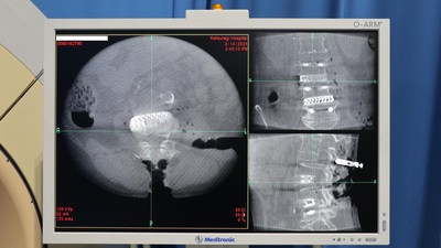 O-Arm Operation Imaging System 4