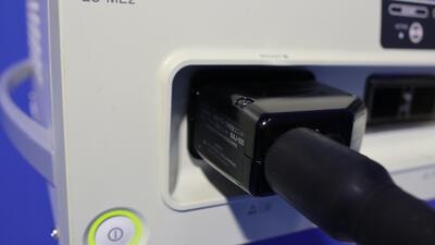Ultrasound Endoscopic Diagnostic System 4