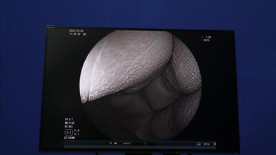 4  4