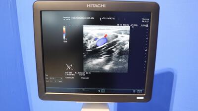 超音波診断装置の写真4枚目