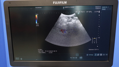 Ultrasound Diagnostic System 4