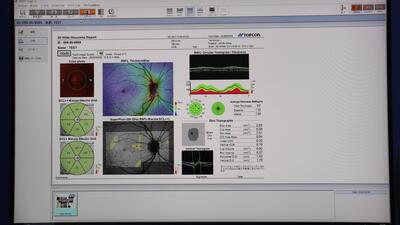 Optical Coherence Tomography 4