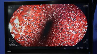Endoscope Light Source & Processor 4