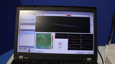 Optical Coherence Tomography 4