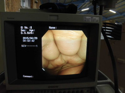 Colon videoscope 5