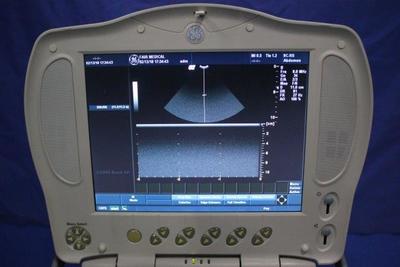 The ultrasonic diagnostic apparatus 5
